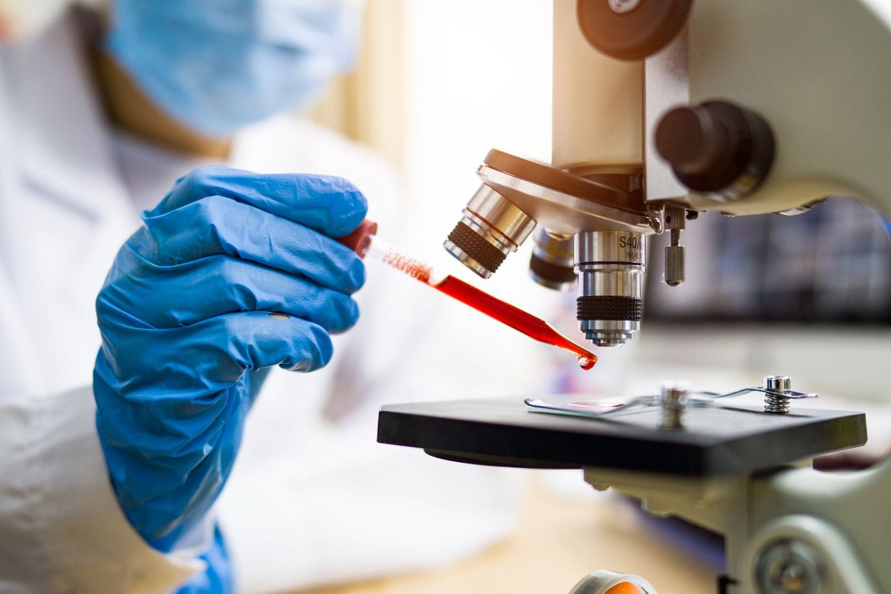 Scientist wearing blue gloves places a drop of red liquid onto a microscope slide under a laboratory microscope.
