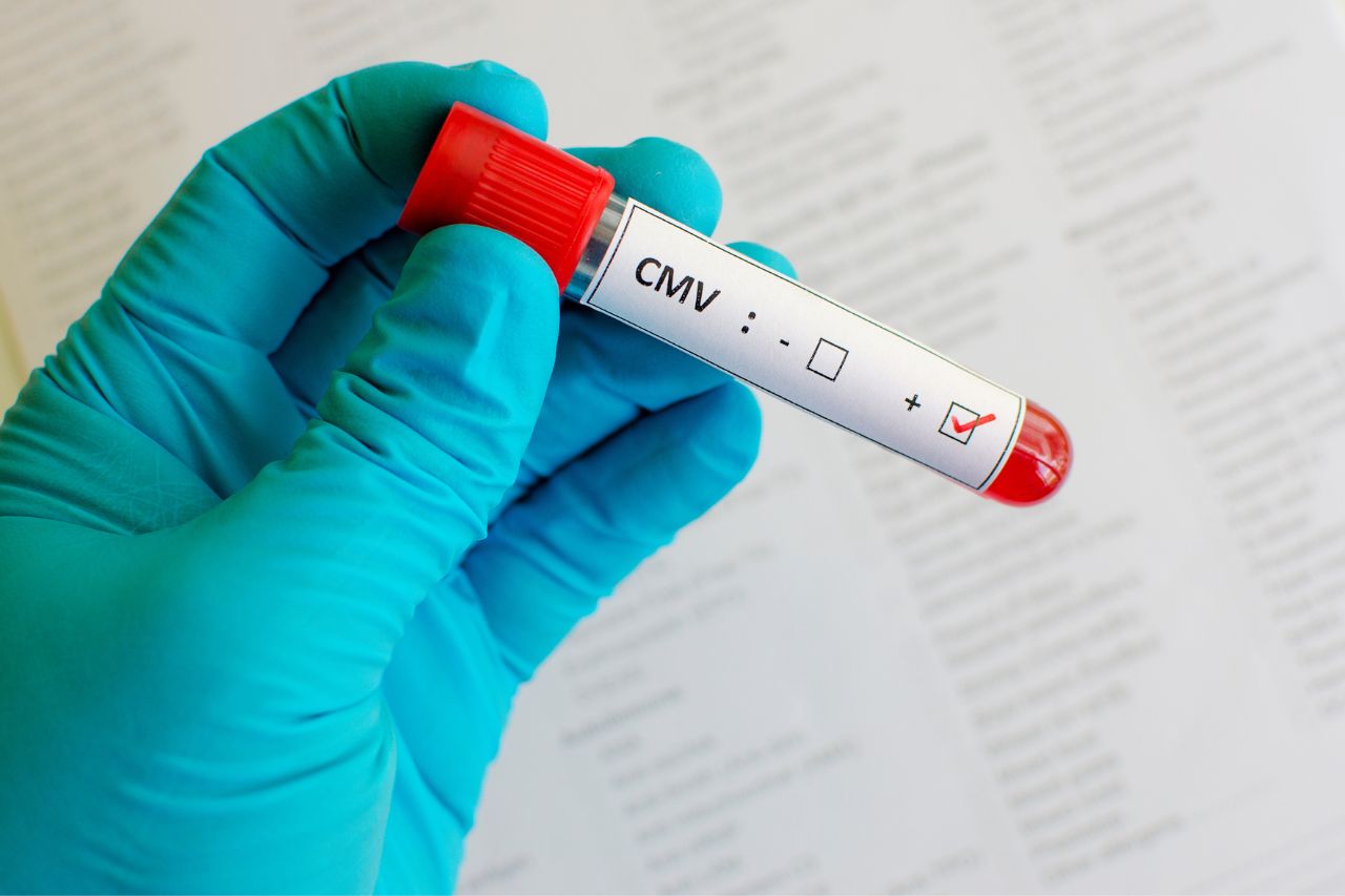 Cytomegalovirus
