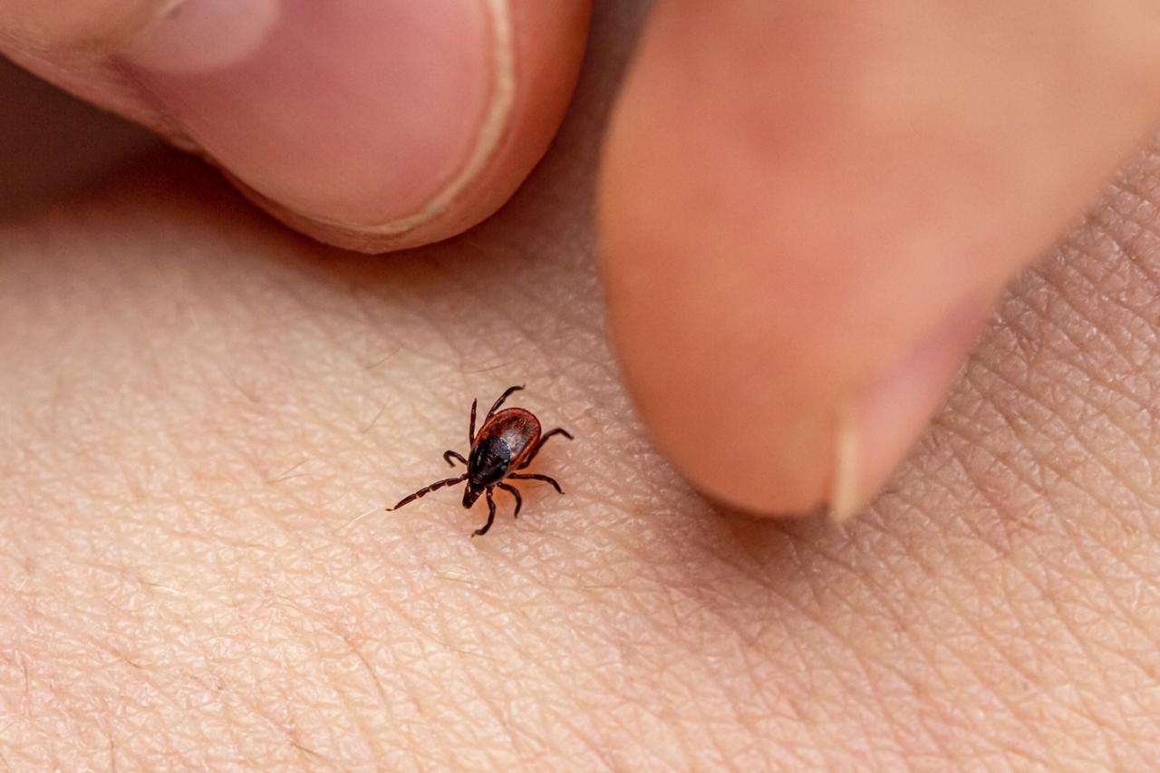 Close-up of a tick on human skin