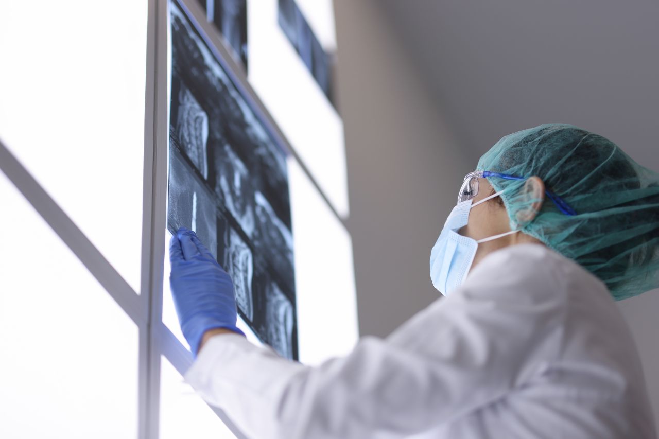scoliosis surgery