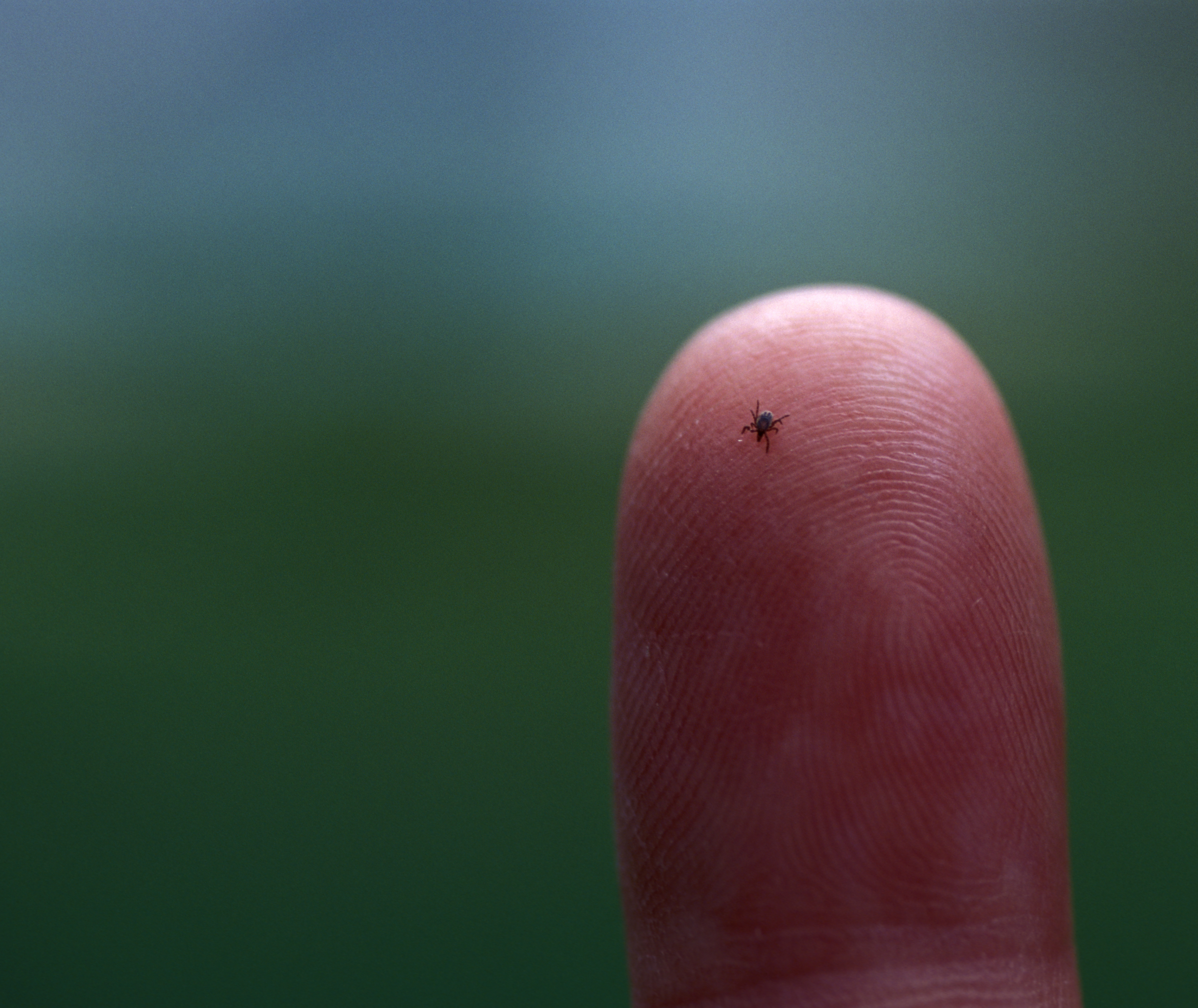 symptoms of lyme disease 