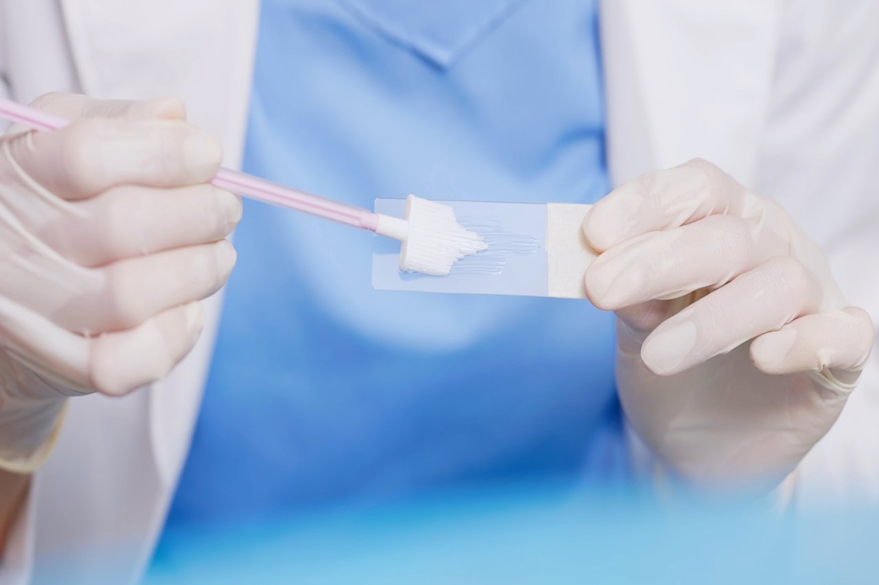 Doctor preparing a lab slide with a medical sample